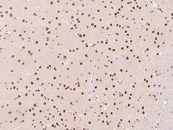 PRMT1 Polyclonal Antibody:Antibodies, Polyclonal