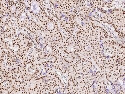 PRMT1 Polyclonal Antibody:Antibodies, Polyclonal