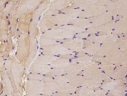 Invitrogen c-Raf Polyclonal Antibody 100 &mu;L; Unconjugated:Antibodies,