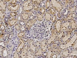 Invitrogen CD264 (TRAIL-R4) Polyclonal Antibody 100 &mu;L; Unconjugated:Antibodies,