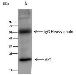 Invitrogen Adenylate Kinase 1 Polyclonal Antibody 100 &mu;L; Unconjugated:Antibodies,