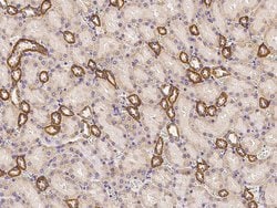 Invitrogen CD297 Polyclonal Antibody 100 &mu;L; Unconjugated:Antibodies,
