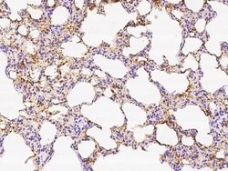 Invitrogen CD93 Polyclonal Antibody 100 &mu;L | Buy Online | Invitrogen&trade; | Fisher Scientific