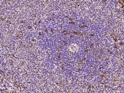 Invitrogen CD93 Polyclonal Antibody 100 &mu;L | Buy Online | Invitrogen&trade; | Fisher Scientific