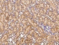 Invitrogen CDH8 Polyclonal Antibody 100 &mu;L; Unconjugated:Antibodies,