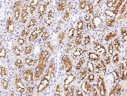 Invitrogen GGT1 Polyclonal Antibody 100 &mu;L; Unconjugated:Antibodies,