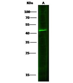 Invitrogen IL20RB Polyclonal Antibody 100 &mu;L | Buy Online | Invitrogen&trade; | Fisher Scientific