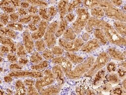 Invitrogen CD73 Polyclonal Antibody 100 &mu;L | Buy Online | Invitrogen&trade; | Fisher Scientific