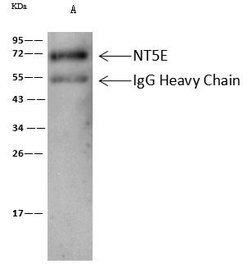 Invitrogen CD73 Polyclonal Antibody 100 &mu;L | Buy Online | Invitrogen&trade; | Fisher Scientific