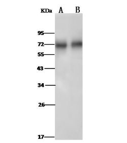 Invitrogen CD73 Polyclonal Antibody 100 &mu;L | Buy Online | Invitrogen&trade; | Fisher Scientific