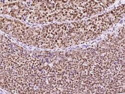 Invitrogen PCNA Polyclonal Antibody 100 &mu;L; Unconjugated:Antibodies,