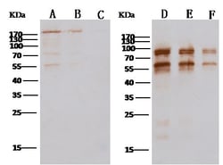 MERS Coronavirus Spike Protein S2 Polyclonal Antibody, Invitrogen&trade;