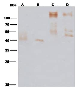Invitrogen&trade;&nbsp;Ebola Virus GP (subtype Zaire, strain Mayinga 1976) Polyclonal Antibody