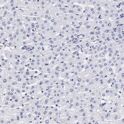 Invitrogen ETV6 Polyclonal Antibody 100 &mu;L; Unconjugated:Antibodies,