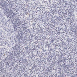 Invitrogen XPNPEP2 Polyclonal Antibody 100 &mu;L | Buy Online | Invitrogen&trade; | Fisher Scientific