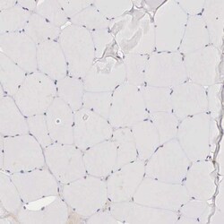 Invitrogen XPNPEP2 Polyclonal Antibody 100 &mu;L | Buy Online | Invitrogen&trade; | Fisher Scientific