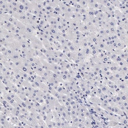 Invitrogen SLITRK4 Polyclonal Antibody 100 &mu;L; Unconjugated:Antibodies,
