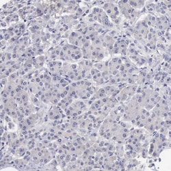 Invitrogen SLITRK4 Polyclonal Antibody 100 &mu;L; Unconjugated:Antibodies,