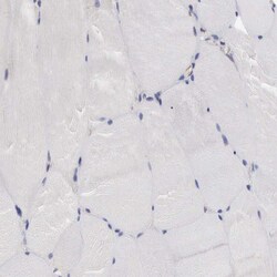 Invitrogen SLITRK4 Polyclonal Antibody 100 &mu;L; Unconjugated:Antibodies,