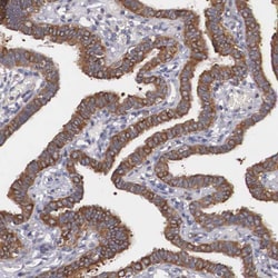Invitrogen GRASP1 Polyclonal Antibody 100 &mu;L; Unconjugated:Antibodies,