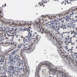 Invitrogen Kaiso Polyclonal Antibody 100 &mu;L; Unconjugated:Antibodies,