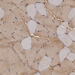 Invitrogen ENO3 Polyclonal Antibody 100 &mu;L; Unconjugated:Antibodies,