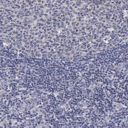 Invitrogen ENO3 Polyclonal Antibody 100 &mu;L; Unconjugated:Antibodies,