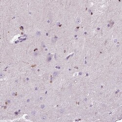 Invitrogen HSPA2 Polyclonal Antibody 100 &mu;L; Unconjugated:Antibodies,