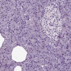 Invitrogen HSPA2 Polyclonal Antibody 100 &mu;L; Unconjugated:Antibodies,