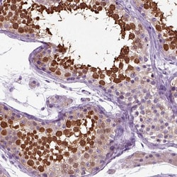Invitrogen HSPA2 Polyclonal Antibody 100 &mu;L; Unconjugated:Antibodies,