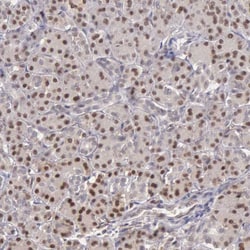 Invitrogen GRK3 Polyclonal Antibody 100 &mu;L; Unconjugated:Antibodies,