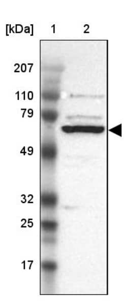 Invitrogen GRK3 Polyclonal Antibody 100 &mu;L; Unconjugated:Antibodies,