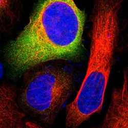 Invitrogen G6PD Polyclonal Antibody 100 &mu;L; Unconjugated:Antibodies,