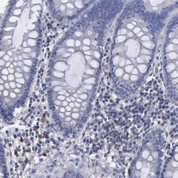 Invitrogen G6PD Polyclonal Antibody 100 &mu;L; Unconjugated:Antibodies,