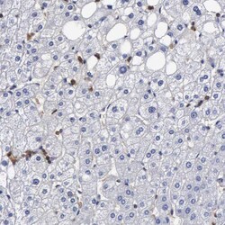 Invitrogen G6PD Polyclonal Antibody 100 &mu;L; Unconjugated:Antibodies,