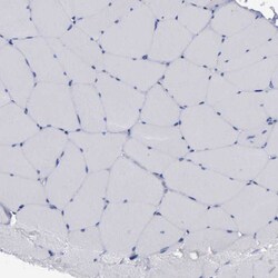 Invitrogen G6PD Polyclonal Antibody 100 &mu;L; Unconjugated:Antibodies,