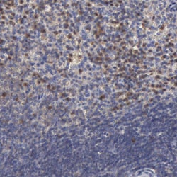 Invitrogen G6PD Polyclonal Antibody 100 &mu;L; Unconjugated:Antibodies,