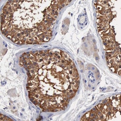 Invitrogen G6PD Polyclonal Antibody 100 &mu;L; Unconjugated:Antibodies,