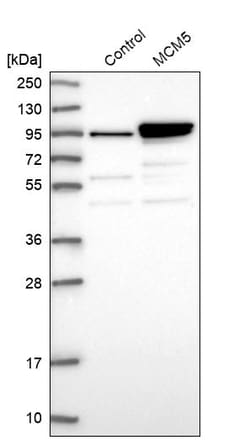 Invitrogen MCM5 Polyclonal Antibody 100 &mu;L | Buy Online | Invitrogen&trade; | Fisher Scientific