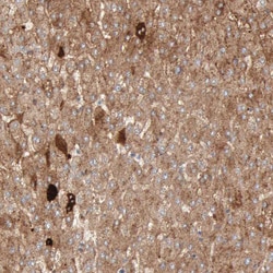 Invitrogen C4BPA Polyclonal Antibody 100 &mu;L | Buy Online | Invitrogen&trade; | Fisher Scientific