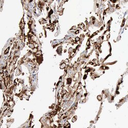 Invitrogen C4BPA Polyclonal Antibody 100 &mu;L | Buy Online | Invitrogen&trade; | Fisher Scientific