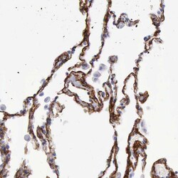 Invitrogen AOC3 Polyclonal Antibody 100 &mu;L; Unconjugated:Antibodies,