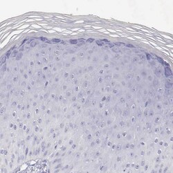 Invitrogen AOC3 Polyclonal Antibody 100 &mu;L; Unconjugated:Antibodies,