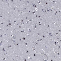 Invitrogen BRD1 Polyclonal Antibody 100 &mu;L; Unconjugated:Antibodies,