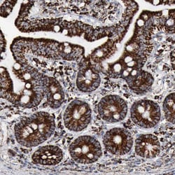 Invitrogen Aconitase 2 Polyclonal Antibody 100 &mu;L | Buy Online | Invitrogen&trade; | Fisher Scientific