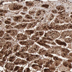 Invitrogen Aconitase 2 Polyclonal Antibody 100 &mu;L | Buy Online | Invitrogen&trade; | Fisher Scientific