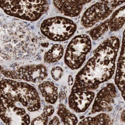 Invitrogen Aconitase 2 Polyclonal Antibody 100 &mu;L | Buy Online | Invitrogen&trade; | Fisher Scientific
