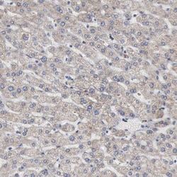 Invitrogen Aconitase 2 Polyclonal Antibody 100 &mu;L | Buy Online | Invitrogen&trade; | Fisher Scientific
