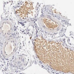 Invitrogen Complement Factor I Polyclonal Antibody 100 &mu;L; Unconjugated:Antibodies,