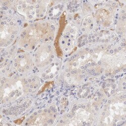 Invitrogen Complement Factor I Polyclonal Antibody 100 &mu;L; Unconjugated:Antibodies,